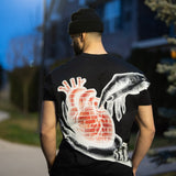 “Heart of bricks” TEE